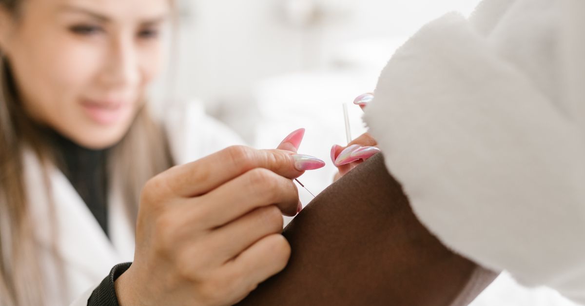 Close-up of a therapist performing acupuncture on a client's arm, promoting holistic health and wellness.